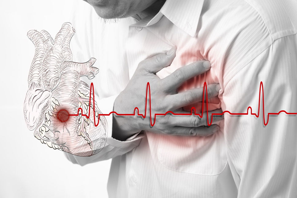 ضعف عضلة القلب - أسباب وأعراض اعتلال / قُصور القلب
