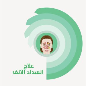 علاج انسداد الانف
