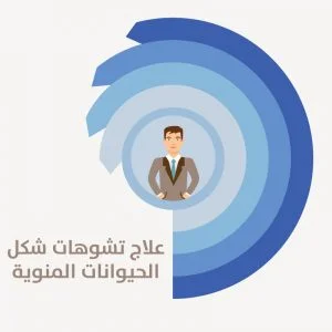 شكل المني