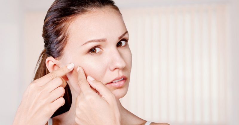 Acne vulgaris