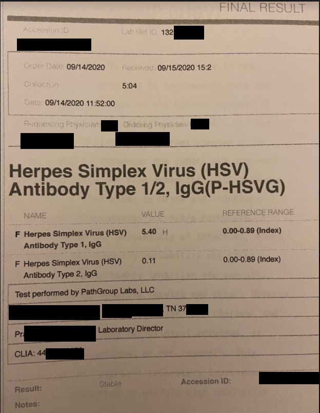 Hsv Test Results Herpes Test Blood Test For Herpes Infection Accesa