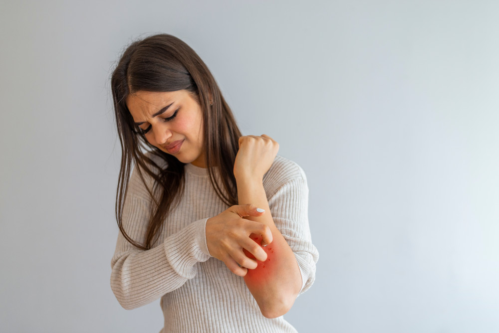 Itching in Multiple Sclerosis: Causes and Relief Methods
